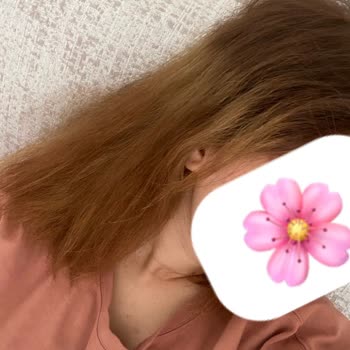 Batuhan Pala Hair Saç Boyama Sonrası Renk Karmaşası Ve Yanma Şikayeti