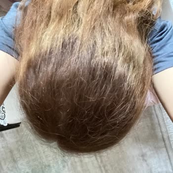 Batuhan Pala Hair Saç Boyama Sonrası Renk Karmaşası Ve Yanma Şikayeti