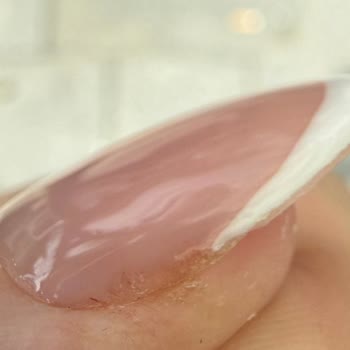 Hijyenik Olmayan Tırnak İşlemi, Kanama Ve Kirpik Dökülmesi, Aşırı Ücret