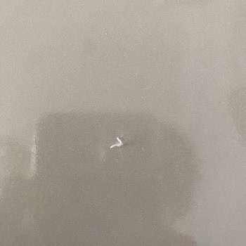 Bebek Bezinde Sert Plastik Parçalar Bulunması