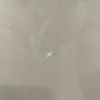 Bebek Bezinde Sert Plastik Parçalar Bulunması