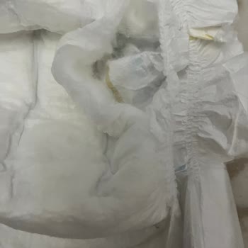 Molfix Ultra Bebek Bezinde Üretim Hatası Ve Cilt Tahrişi