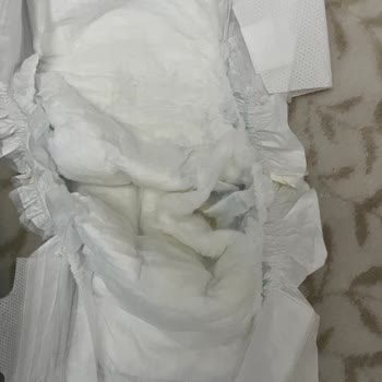 Molfix Ultra Bebek Bezinde Üretim Hatası Ve Cilt Tahrişi