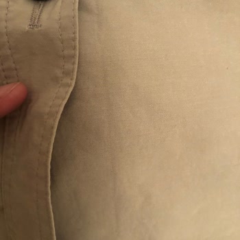 Trençkotta Yıkama Sonrası Sarı Çizgiler Ve Bilek Defosu