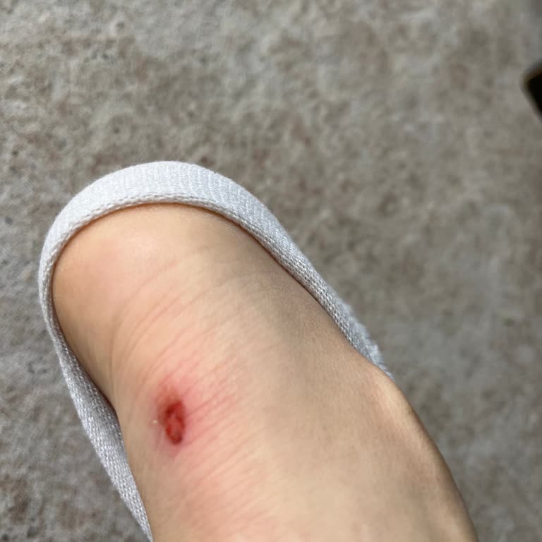 Lumberjack Ayakkabısındaki Defekt Ve Mağaza İade Reddi