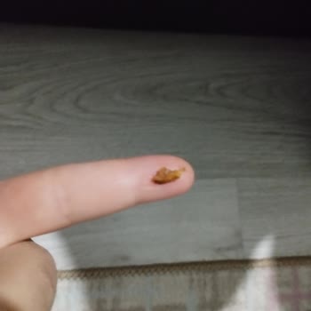 Fındıklı Çikolatada Kabuğun Çocuğun Dişi Neredeyse Kırıldı