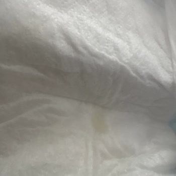 Molfix 6 Numaralı Bezlerde Yapışkan Hatası Ve Hijyen Endişesi