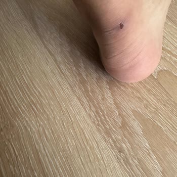 İç Astar Kusuru Nedeniyle Ayakkabı İadesi Talebi