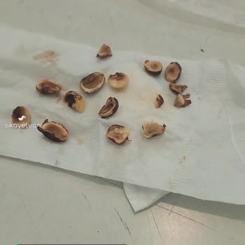 Kahve Dünyası Çikolata Bozuk, Bozuk Fındıklar!