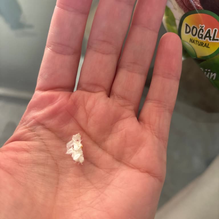 Getir Üzerinden Aldığım Kayısı Ürününde Plastik Parça Bulunması Sağlık Riskine Yol Açtı
