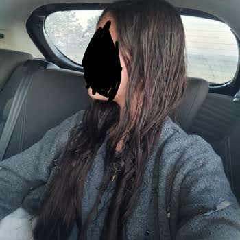Aşırı Yağlı Saç Bırakan Bit Bit Sprey İçin Acil Çözüm Talebi