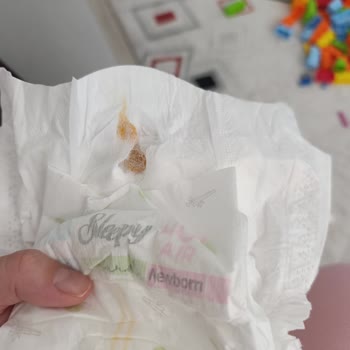 Sleepy Natural 1 Numaralı Bezde Sert Yabancı Madde Tespiti