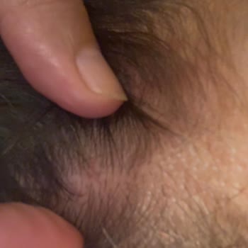 Şampuan Saç Dökülmesine Neden Oluyor, İade Talebi