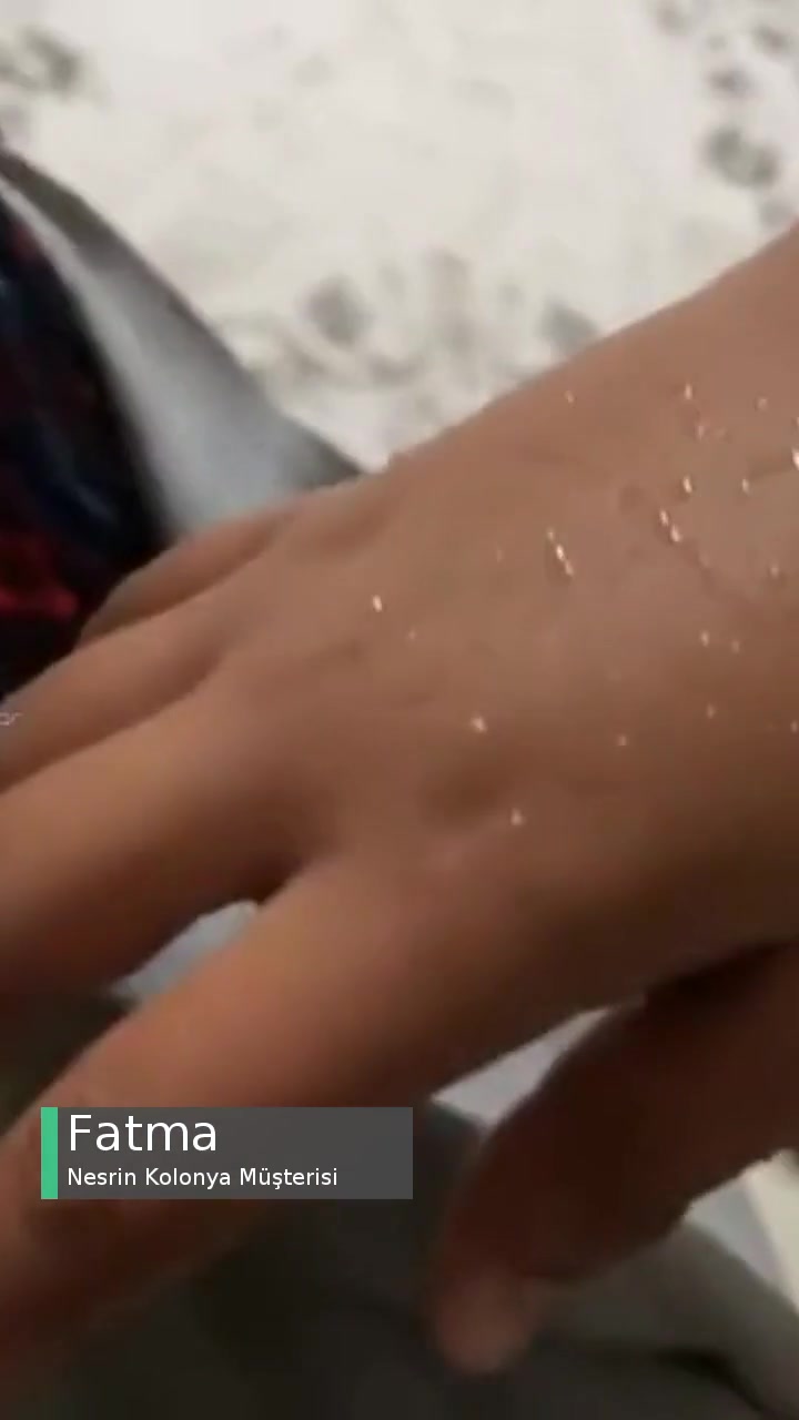Nesrin Kolonya Alerjiye Sebep Oldu! videonun kapak resmi