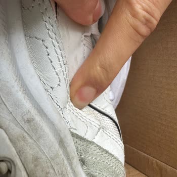 Skechers D'Lites Ayakkabısında Üretim Hatası Nedeniyle Açılma Ve Sökülme