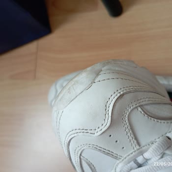 Skechers Ayakkabısının Kısa Sürede Patlaması Ve Mağazanın Reddedilen İade Kararı