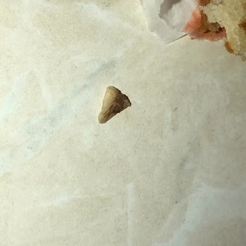 Burgerde Kemiğin Bulunması Ve Sağlık Riski İçin Yetersiz Tazminat