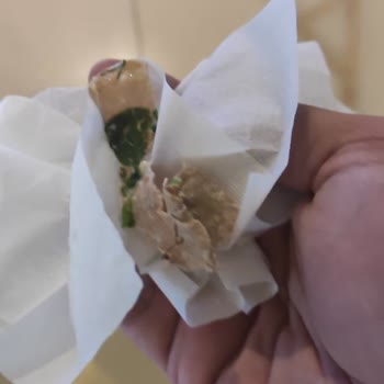 Yara Bandı Bulunan Yemekte Hijyen Skandalı Otelden Açıklama, Özür Ve Ücret İadesi Talebi