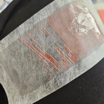 Vivet Ağda Bandı Yarım Çıktı Ve Cilde Yapıştı