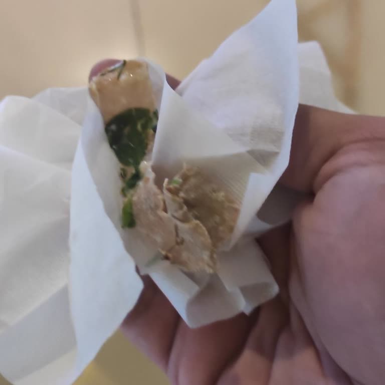 Otelde Yara Bandı Bulundu: Hijyen Skandalı Ve Ücret İadesi Talebi