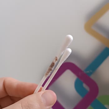 Apaks Pamuklu Çubuklarda Kir Görüldü, Hijyen Güven Kaybı