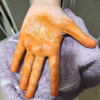 Makbul Kınası Çocuklarda Akıp Bulaştı, Sağlık Riski
