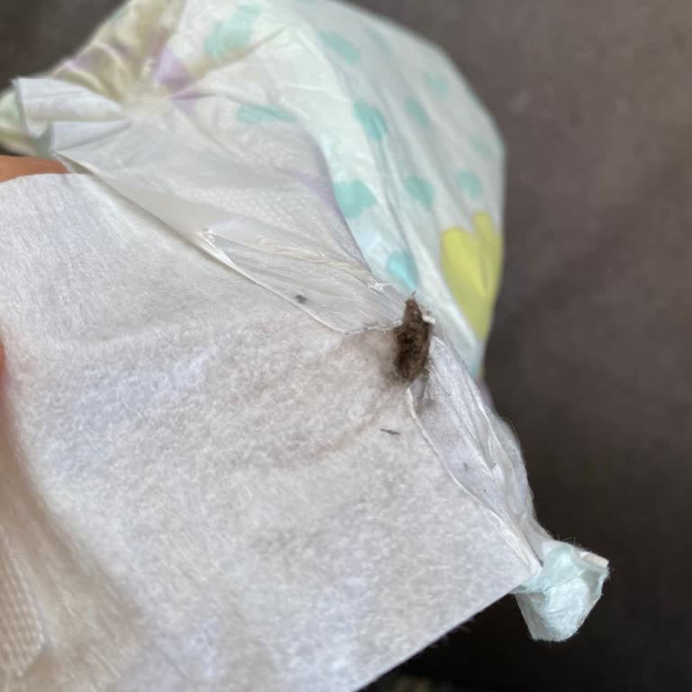 Jenny&Willy Bebek Bezinde Sert Siyah Cisim Görüldü