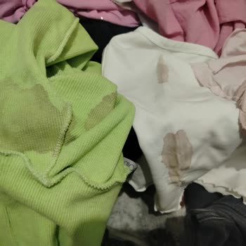 Sivas Tur’da Kurban Etlerinin Kan Sızıntısı Valiz Ve Kıyafetlerimi Kirletti