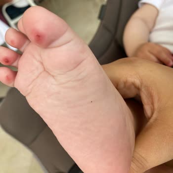 Hijyen Ve Havuz Güvenliği Çocukları Tehlikeye Atıyor