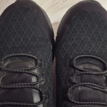 Skechers Dynamight 2.0 Ayakkabımda Erken Deformasyon Ve Trendyol’dan Değişim Reddi