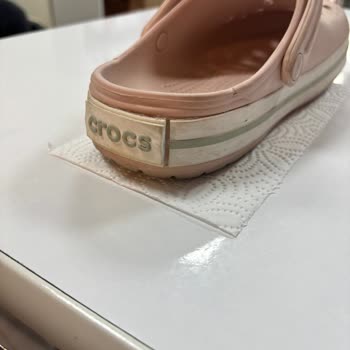 Crocs Terliğinde Bant Ayrılması Ve İade Talebi