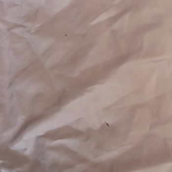 Yanıltıcı Satışla Gelen Kirli, Yırtık Ve Sigara Kokulu Yağmurluk