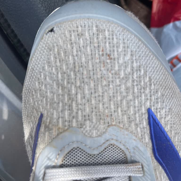 Kısa Sürede Delinen Adidas Ayakkabı İçin Yanlış Kullanıcı Hatası İddiası