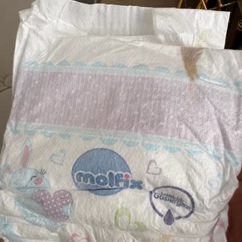Molfix Bebek Bezinde Yapışık Lekeler Görülüyor