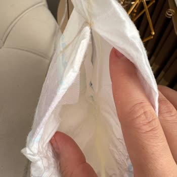 Molfix Bebek Bezinde Yapışık Lekeler Görülüyor