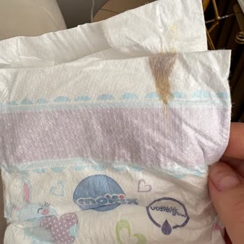 Molfix Bebek Bezinde Yapışık Lekeler Görülüyor