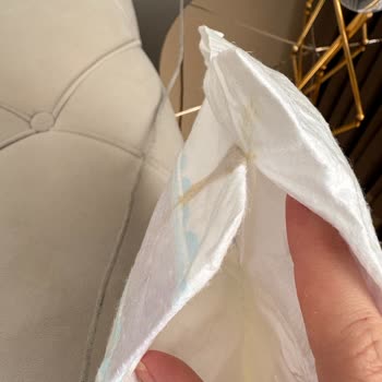 Molfix Bebek Bezinde Yapışık Lekeler Görülüyor
