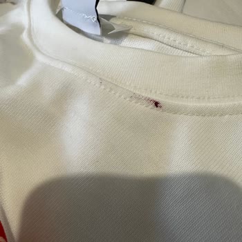 Zara'dan Gelen Kusurlu Ürün Ve Sorunlu İade Süreci