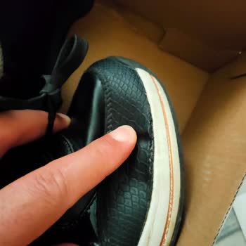 Skechers Ayakkabım Kısa Sürede Açıldı, Kullanıcı Hatası İddiası Kabul Edilemez