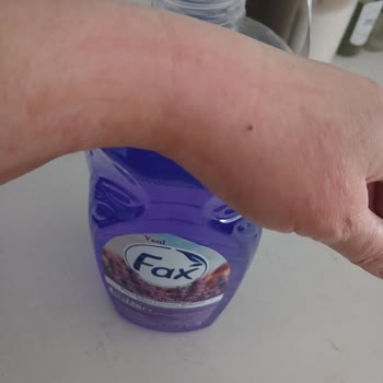 Migros Sabunu Alerjik Reaksiyon Yaratıyor, 15 Gün Kuralı İadeyi Engelliyor