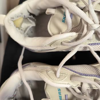Beymen Garanti İncelemesi Sonuçsuz, Skechers Ayakkabı Değişimi Talep Ediyorum