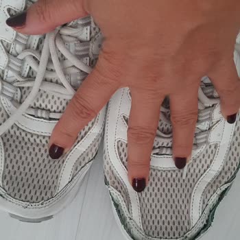 Skechers GO Run Consistent 2.0 Ayakkabısının Bir Ayda İçten Açılması Ve Para İadesi Talebi