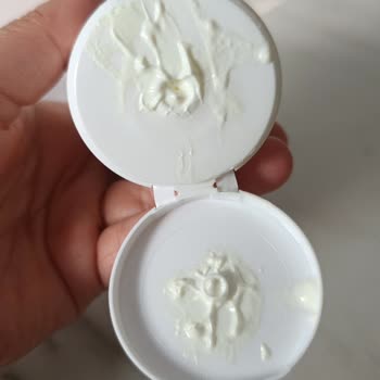 Yoğurt Kesikli Güneş Kremi Ve Kaşıntı Şikayetim