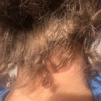 Saçlarım Koptu, Derim Yanıyor: 12 Bin TL'lik Kuaför Faciası