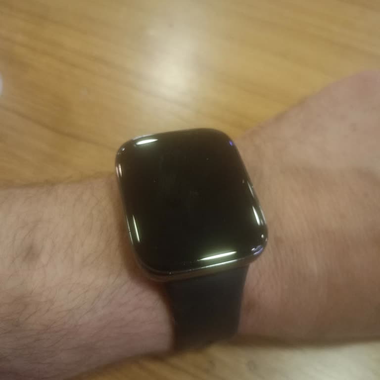 Xiaomi Mi Watch 3 Active Batarya Sorunu Ve Garanti Kapsamında Değişim Talebi