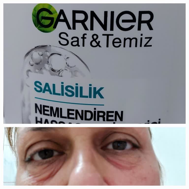 Garnier Temizleyicide Göz Yanması Ve Alerjik Reaksiyon