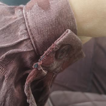 Kısa Sürede Solan Ve Beyaz Çizgili Saten Gömlek İçin İade Talebi