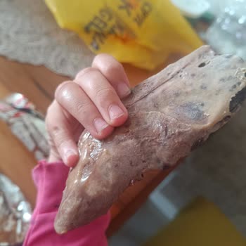 Algida Volcano Dondurmasında Gizli Çubuk Nedeniyle Diş Kırılması Ve Tazminat Talebi