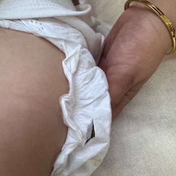 Sleepy 5 Numaralı Cırtlı Bebek Bezinde Görünmeyen Yırtık Sorunu