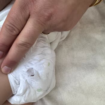 Sleepy 5 Numaralı Cırtlı Bebek Bezinde Görünmeyen Yırtık Sorunu